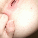 fap